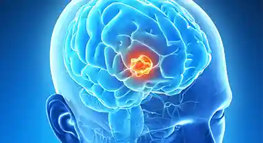 Brain Tumour & Neuro-Oncology Services