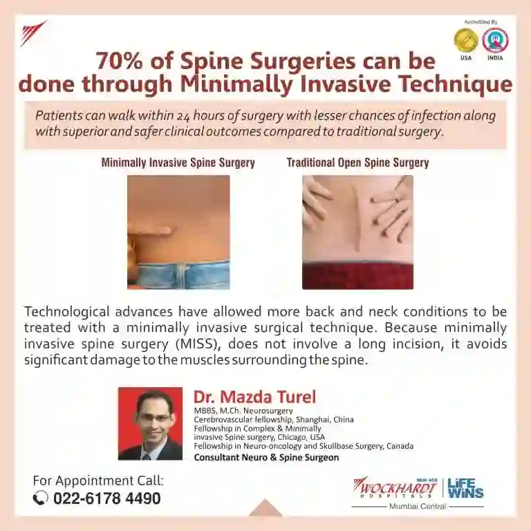 70% of Spine Surgeries Can Be Done Through Minimally Invasive Technique