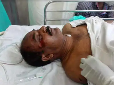 Constable Suffers Head Injury After Scooter Bangs into Him