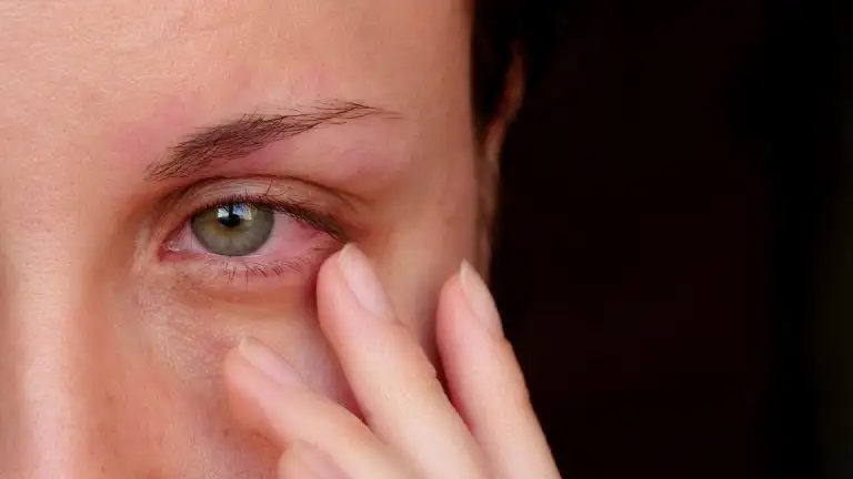 Eye Infections During Monsoon: Some Full-Proof Tricks To Protect Your Peepers