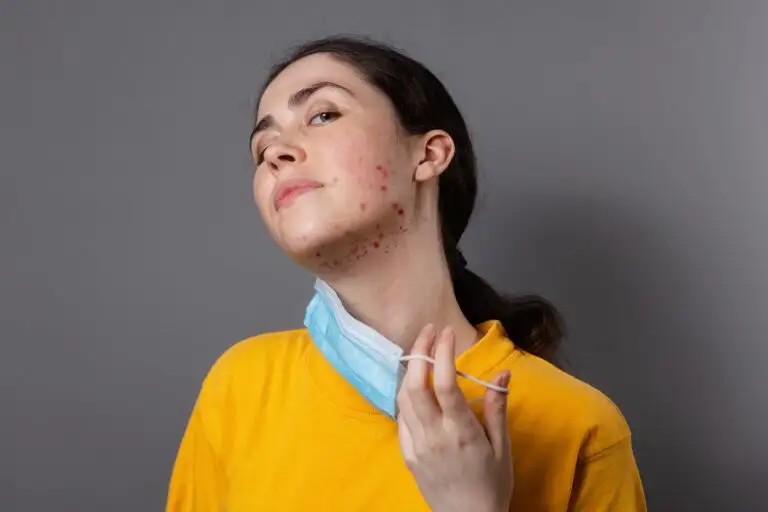 18-Yr-Old Teen Fought A Rare Fungal Infection; Goes Home After 2 Months