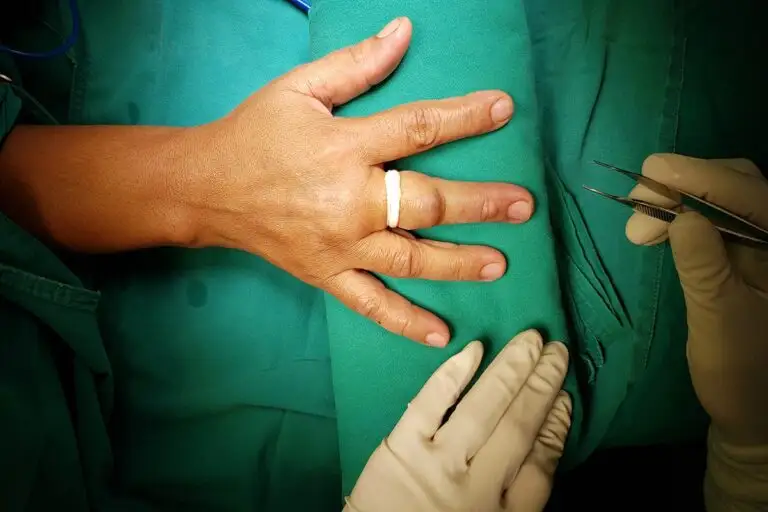 Mumbai Doctors Re-Join Severed Index Finger Of 20-Month-Old Child