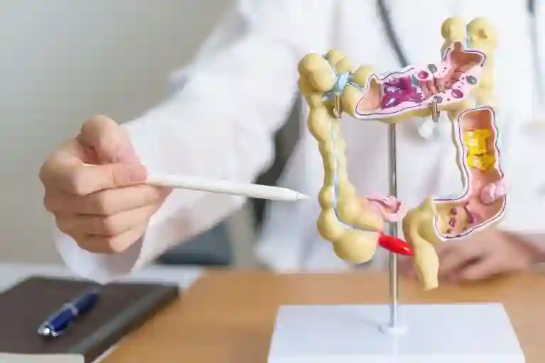 Colorectal Cancer Diagnosis, Treatment & Surgery