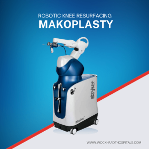 Makoplasty - Robotic Knee Resurfing