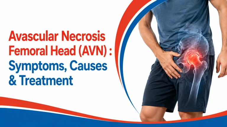 avascular necrosis of femoral head