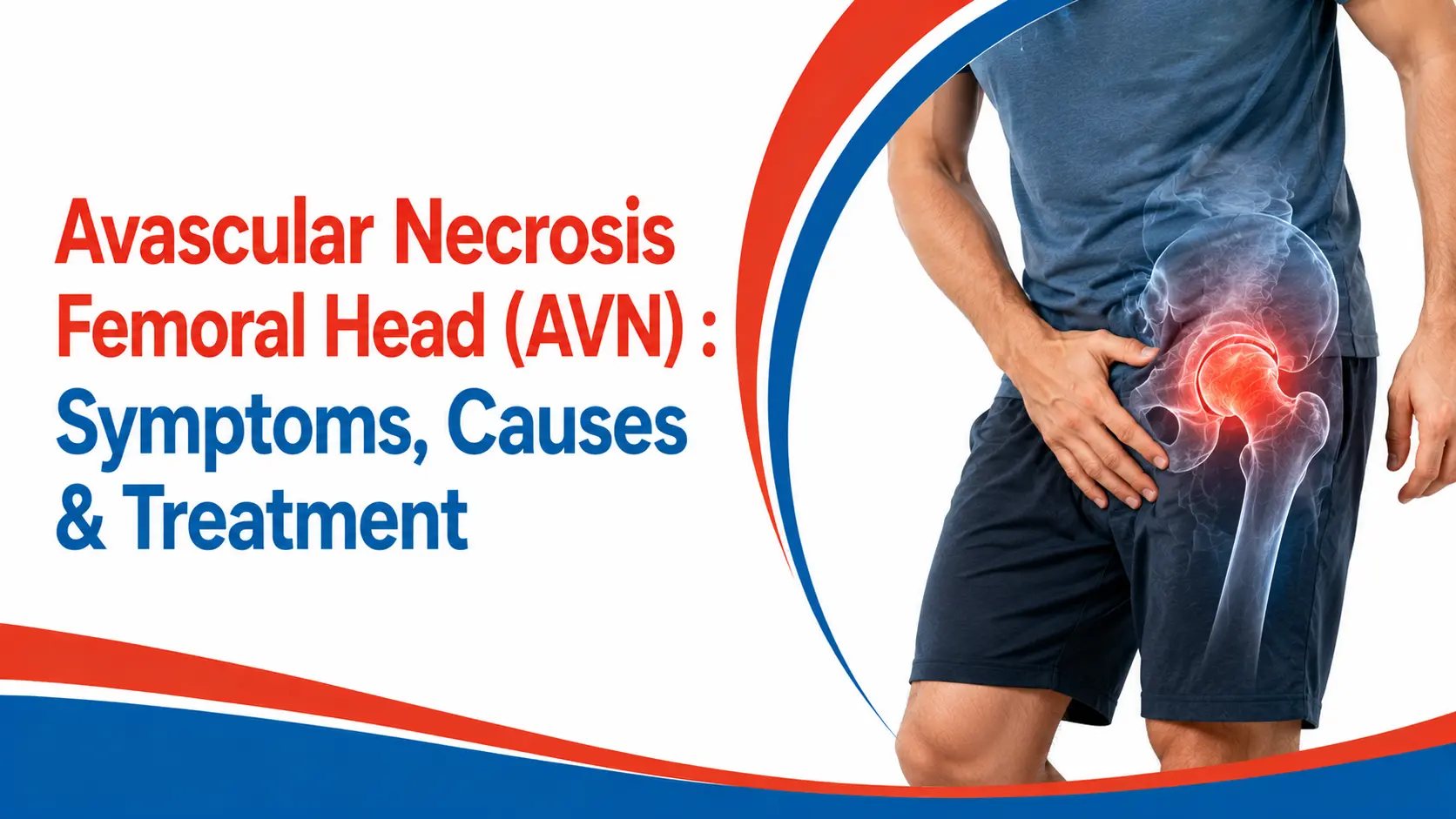 avascular necrosis of femoral head
