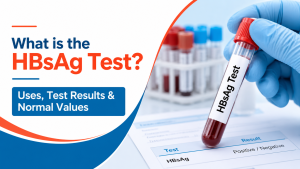 HBsAg test