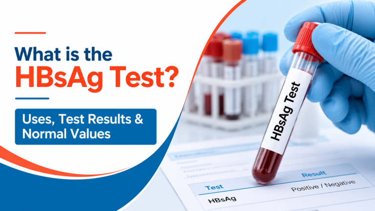 HBsAg test