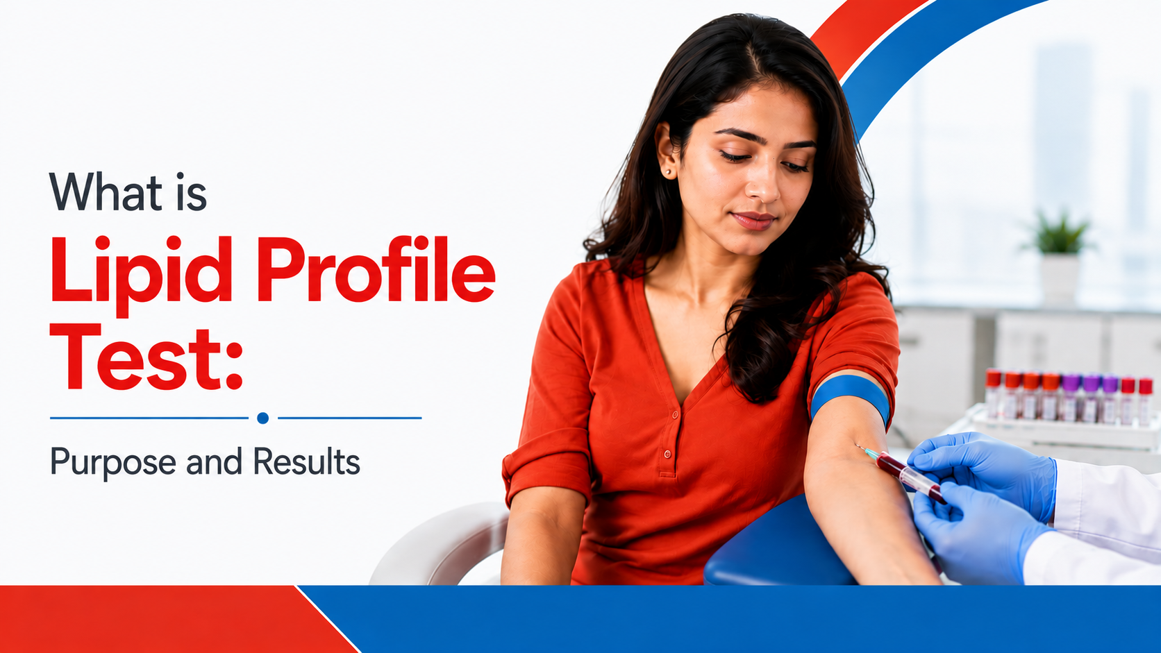 lipid profile test
