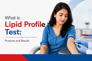 lipid profile test