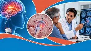 deep brain stimulation
